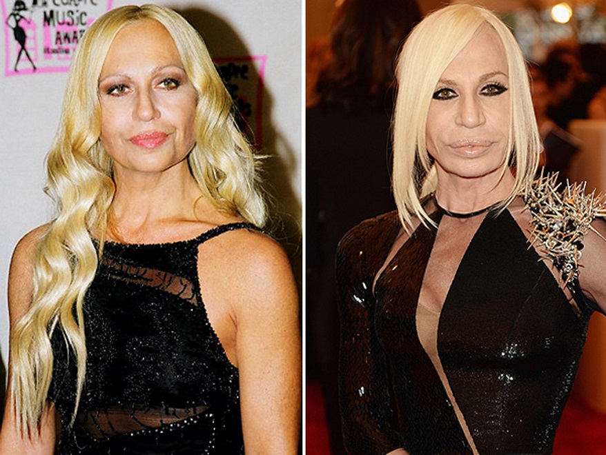 Donatella Versace: antes e depois das cirurgias - FlashVidas - Vidas